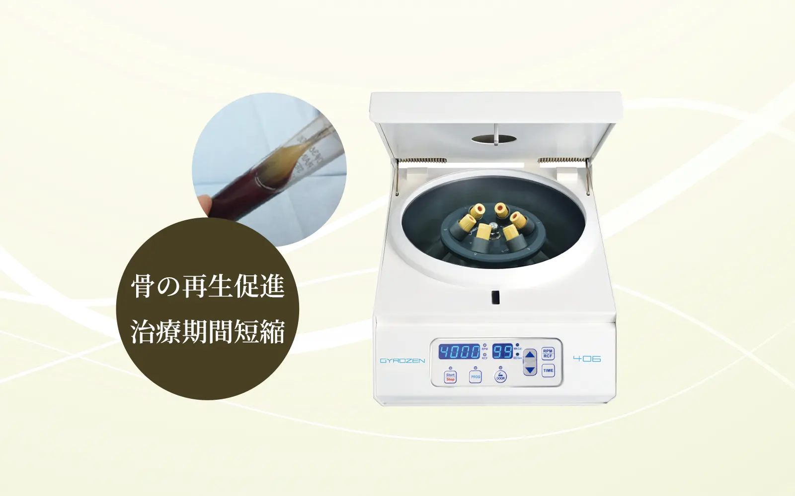 再生力の高い治療