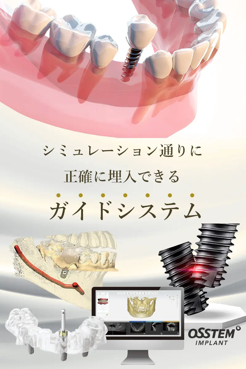 インプラント相談