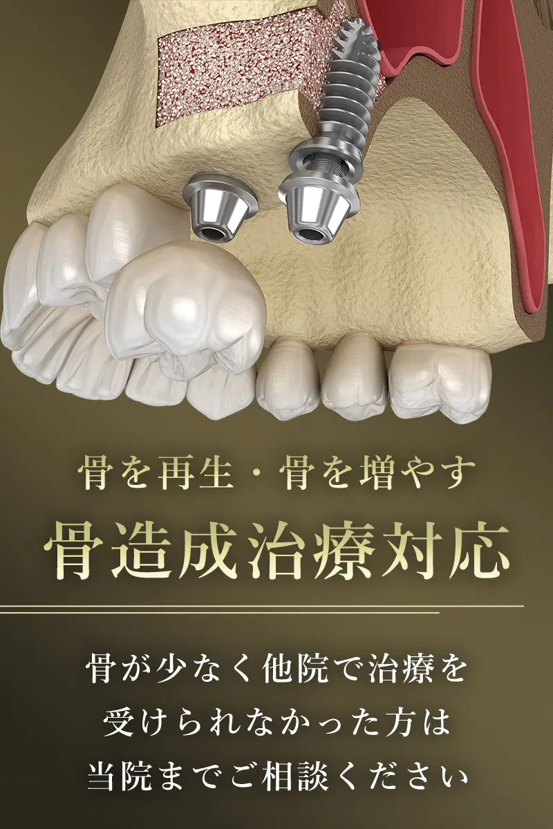 骨造成
