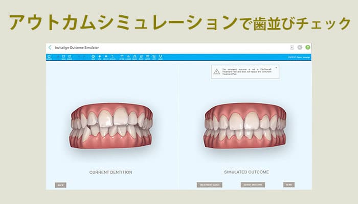 アウトカムシミュレーション